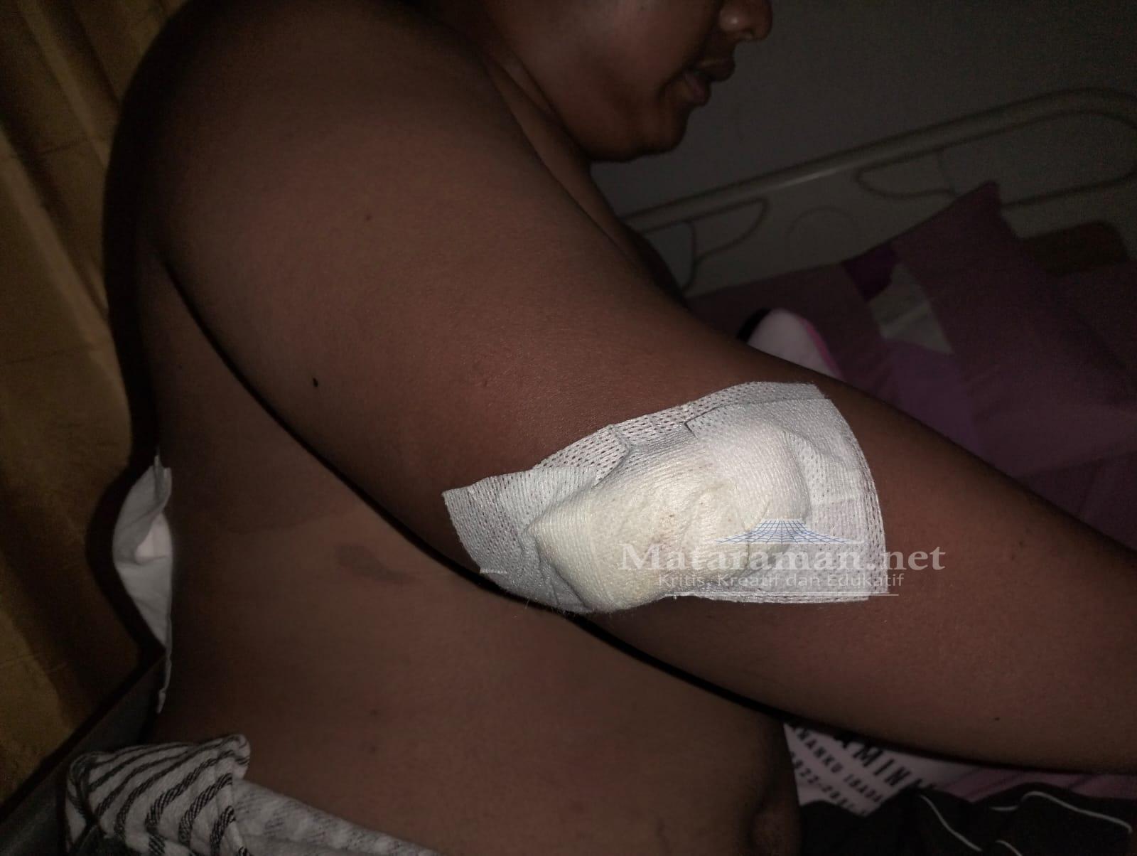 Bentrokan Antar Perguruan Silat, Sepeda Motor Dibakar Hingga Satu Orang Terkena Luka Bacok